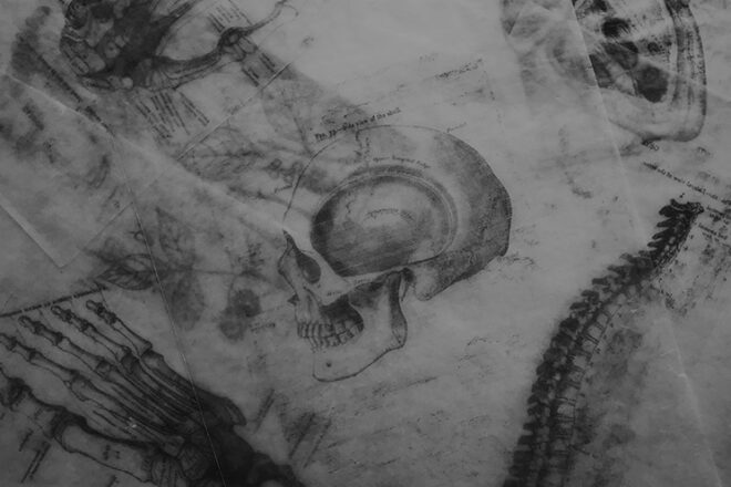 Best Emerging Writers 2024: “Disfigured: An Essay” by Emilie Pascale Beck